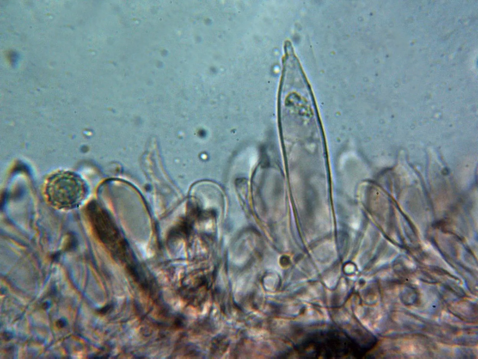 Microscopía de Russula aurea - 10 - Arista laminar 1